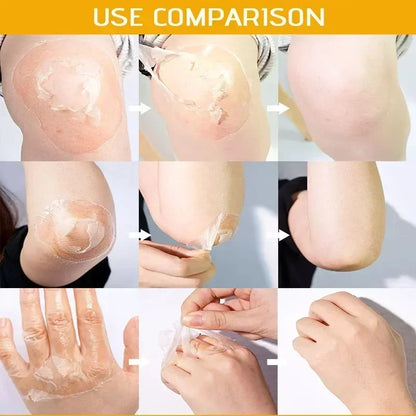 Yellow Peeling Lotion – 100% Organic Body Scrub with Hyaluronic Acid, Dark Skin Bleaching, Exfoliating, Whitening & Moisturizing