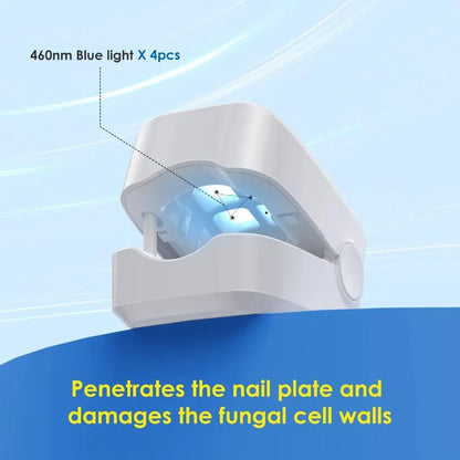 Rechargeable Infrared Nail Fungus Treatment Device – Effective Toenail Fungal Infection Removal Machine for Nail Care