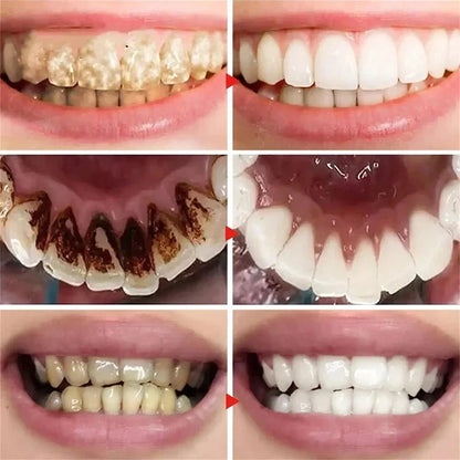 V34 Teeth Whitening Toothpaste – 5D Whitening Stick for Oral Hygiene, Cleaning & Fresh Breath Care