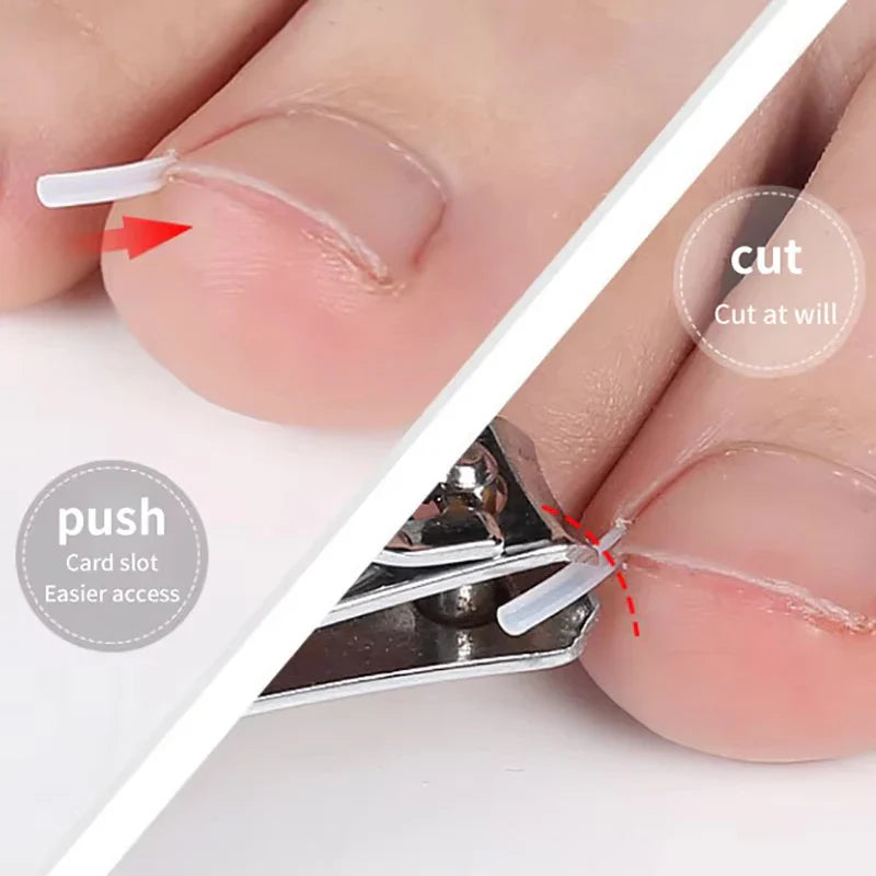 50PCS Ingrown Toenail Correction Kit – Invisible Nail Straightening Clips & Treatment Pads for Foot Care