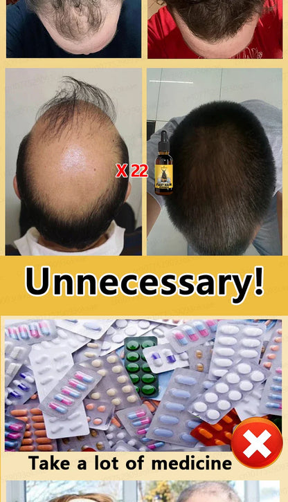 Rapid Hair Growth Serum – Beard, Chest & Body Hair Enhancer for Fuller, Thicker Growth
