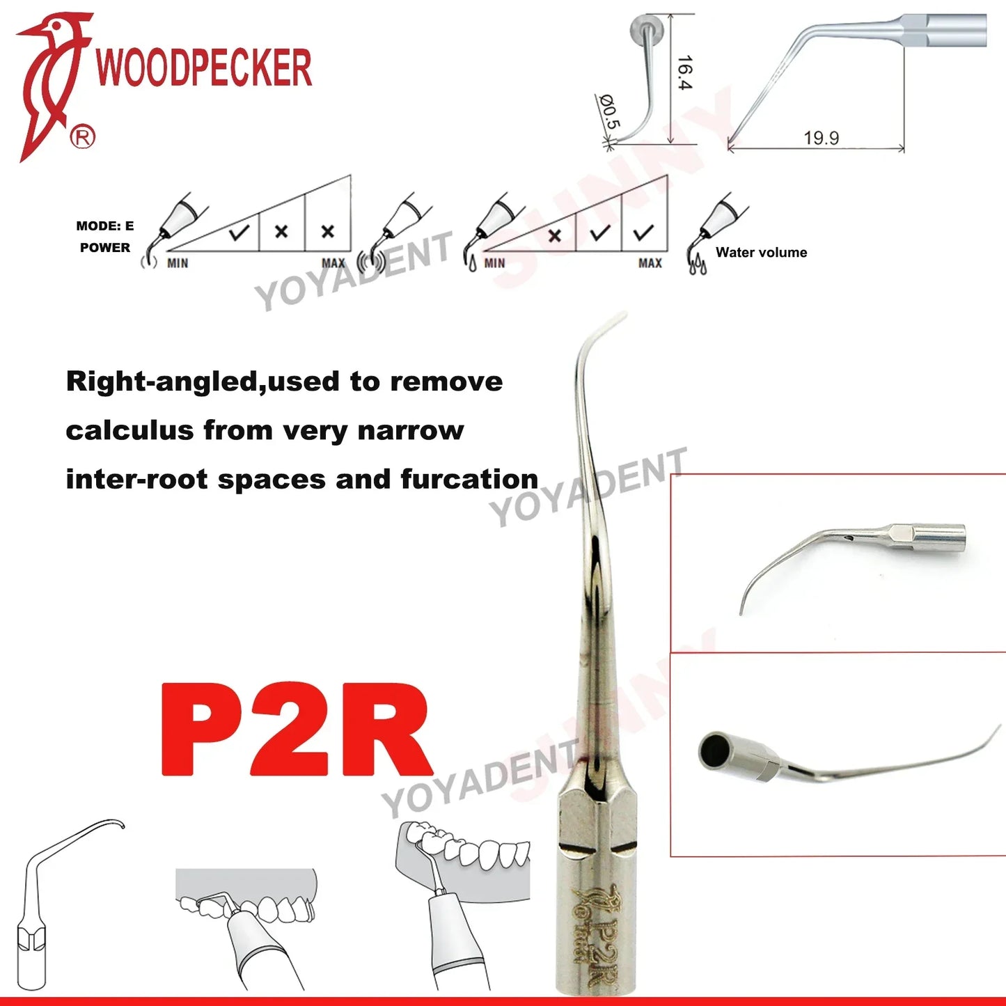 Woodpecker Dental Scaler Tips – Ultrasonic Tooth Cleaning, Endo & Perio Scaling Tips, Fit EMS UDS Scaler Handpiece