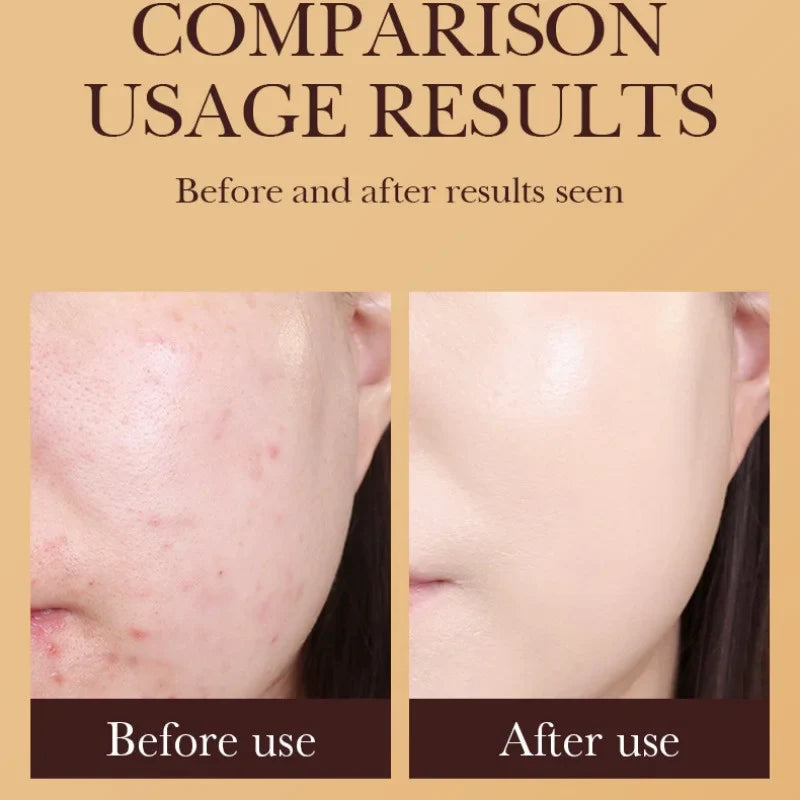 SADOER Gold Snail BB Cream — Oil-Control Matte Foundation & Concealer SPF50+ PA+++ 40g