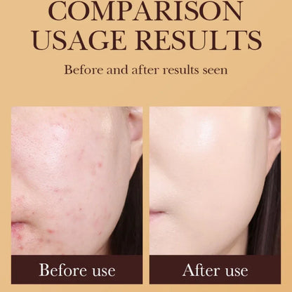 SADOER Gold Snail BB Cream — Oil-Control Matte Foundation & Concealer SPF50+ PA+++ 40g