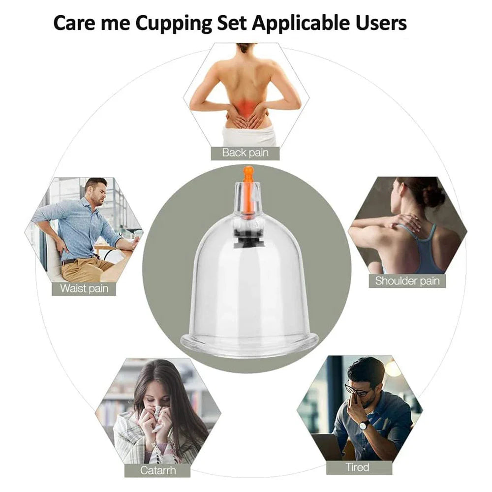 32-Can Thickened Household Vacuum Cupping Machine — Non-Glass Health Massage Tool