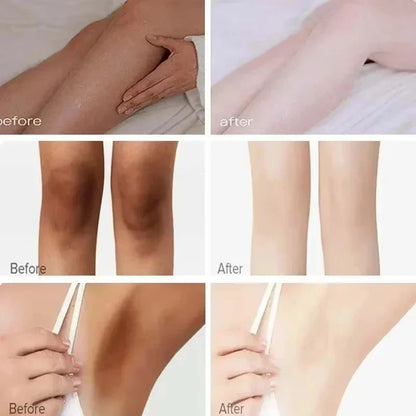 Body Whitening Cream for Arms, Thighs, Underarms & Knees – Brightening Moisturizing Essence for Even Tone Skincare Treatment