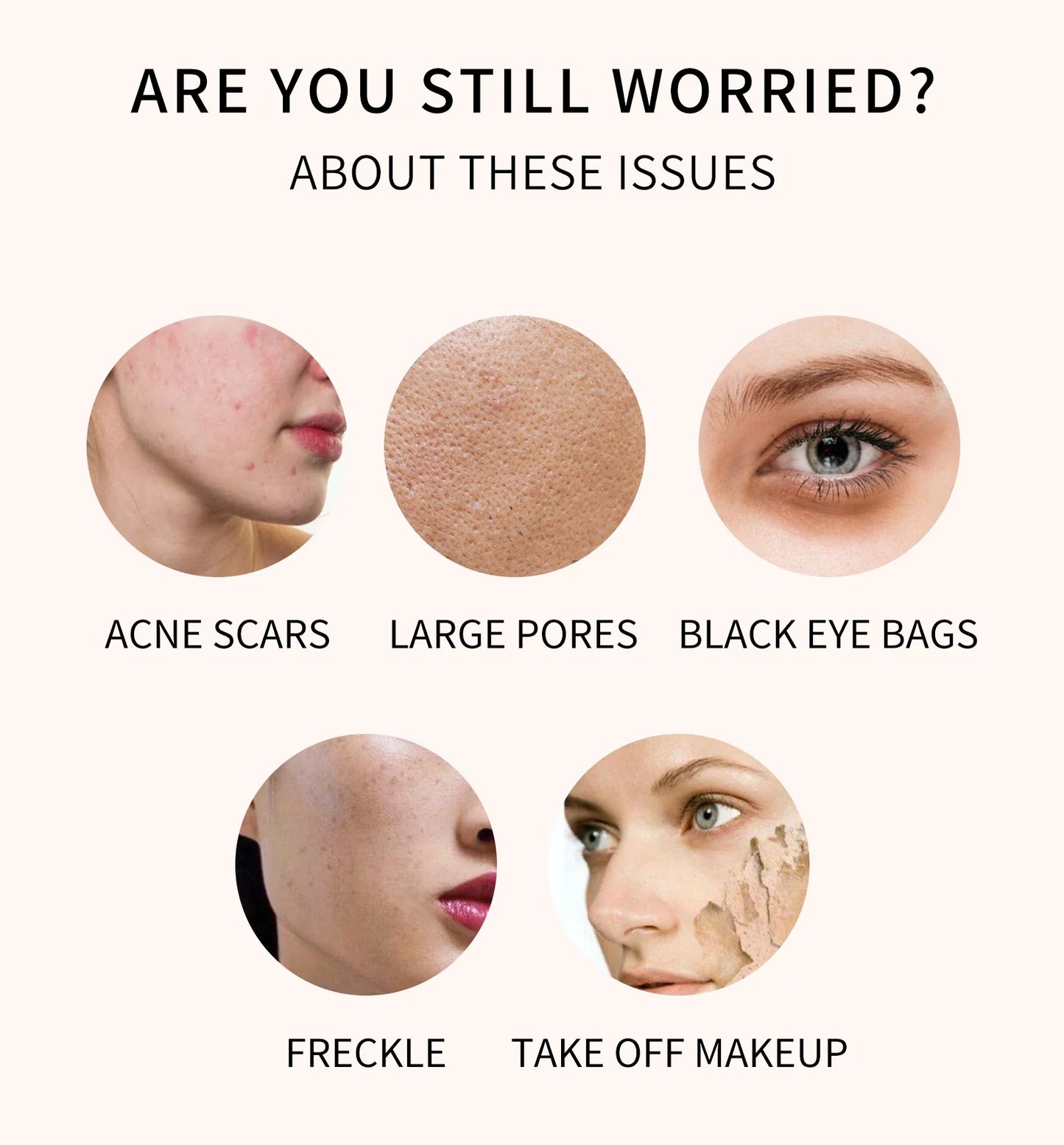 High Coverage Concealer – Anti-Dark Circle, Freckle & Long-Lasting Waterproof BB Cream Foundation for Face Makeup