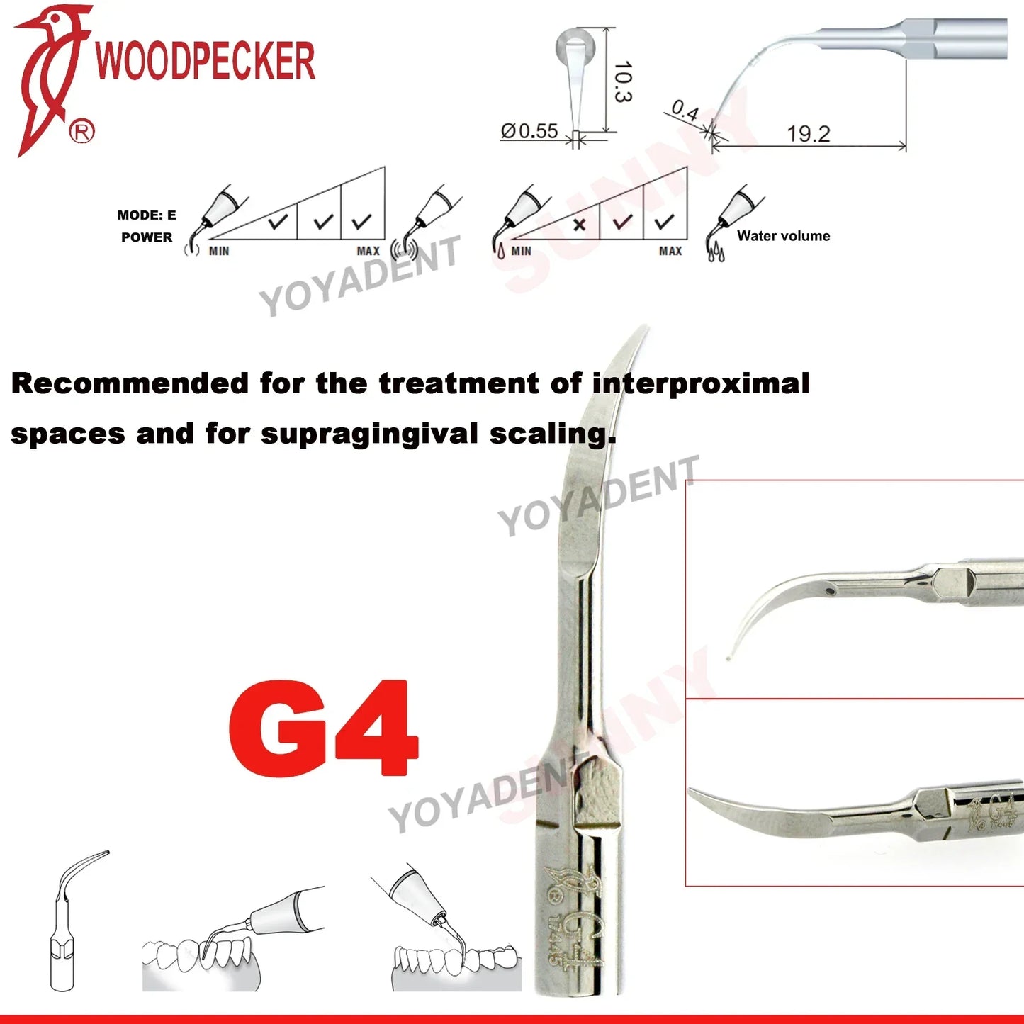 Woodpecker Dental Scaler Tips – Ultrasonic Tooth Cleaning, Endo & Perio Scaling Tips, Fit EMS UDS Scaler Handpiece