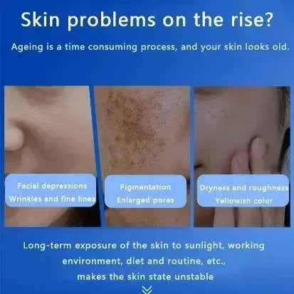 80% Blue Sponge Microalgae Kit – Natural Collagen Regeneration & Skin Resurfacing Extract