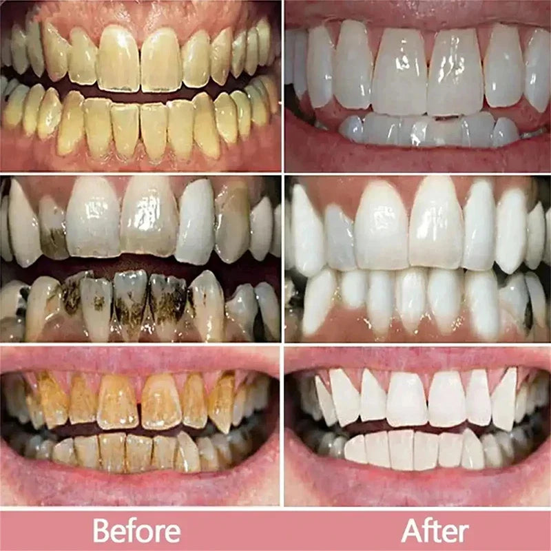 V34 Teeth Whitening Toothpaste – 5D Whitening Stick for Oral Hygiene, Cleaning & Fresh Breath Care