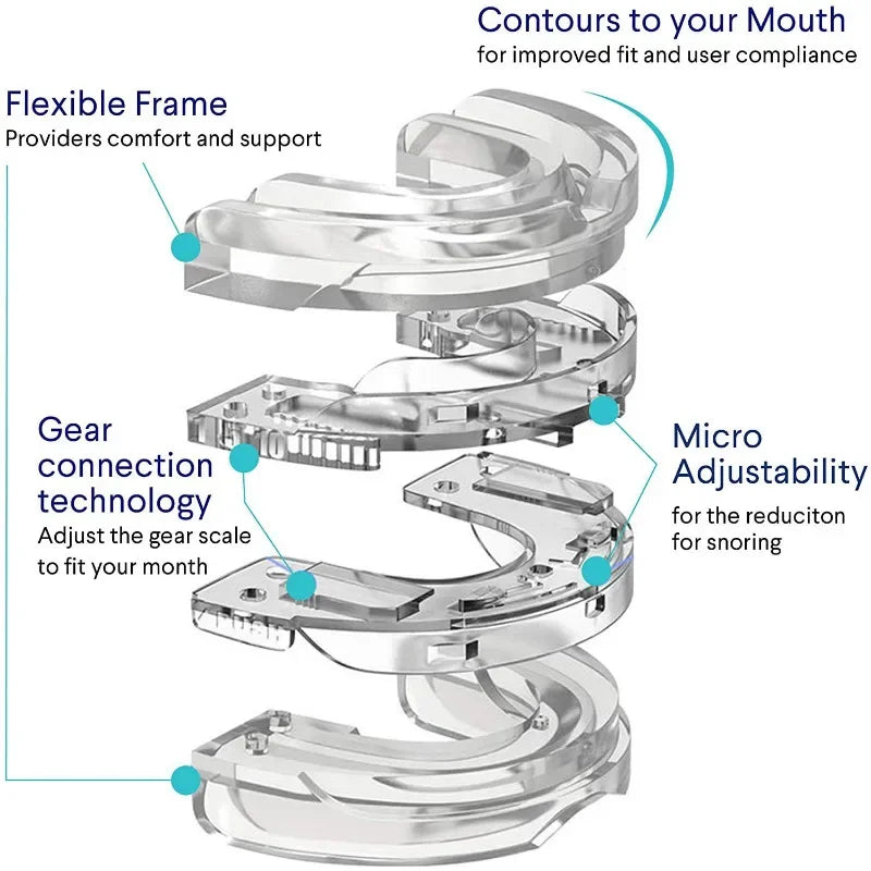 Anti-Snoring Mouth Guard: Stop Snoring, Improve Sleep, and Prevent Teeth Grinding - Effective Bruxism and Apnea Solution