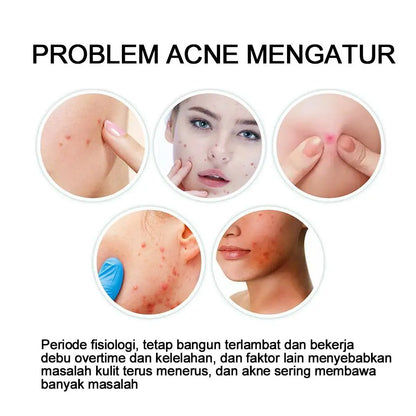 72pcs Invisible Anti-Acne Pimple Patches – Hydrocolloid Waterproof Spot & Mark Repair Stickers