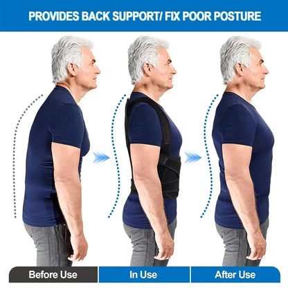 Adjustable Posture Corrector Back Brace – Orthopedic Spinal Support for Men & Women, Comfortable Upper Back Strap
