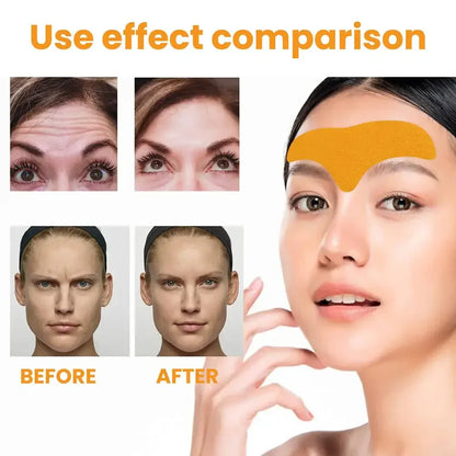 Forehead Wrinkle Patches Anti-Wrinkle Gel Pads – Natural Forehead Line Removal Facial Patches (10–100pcs)