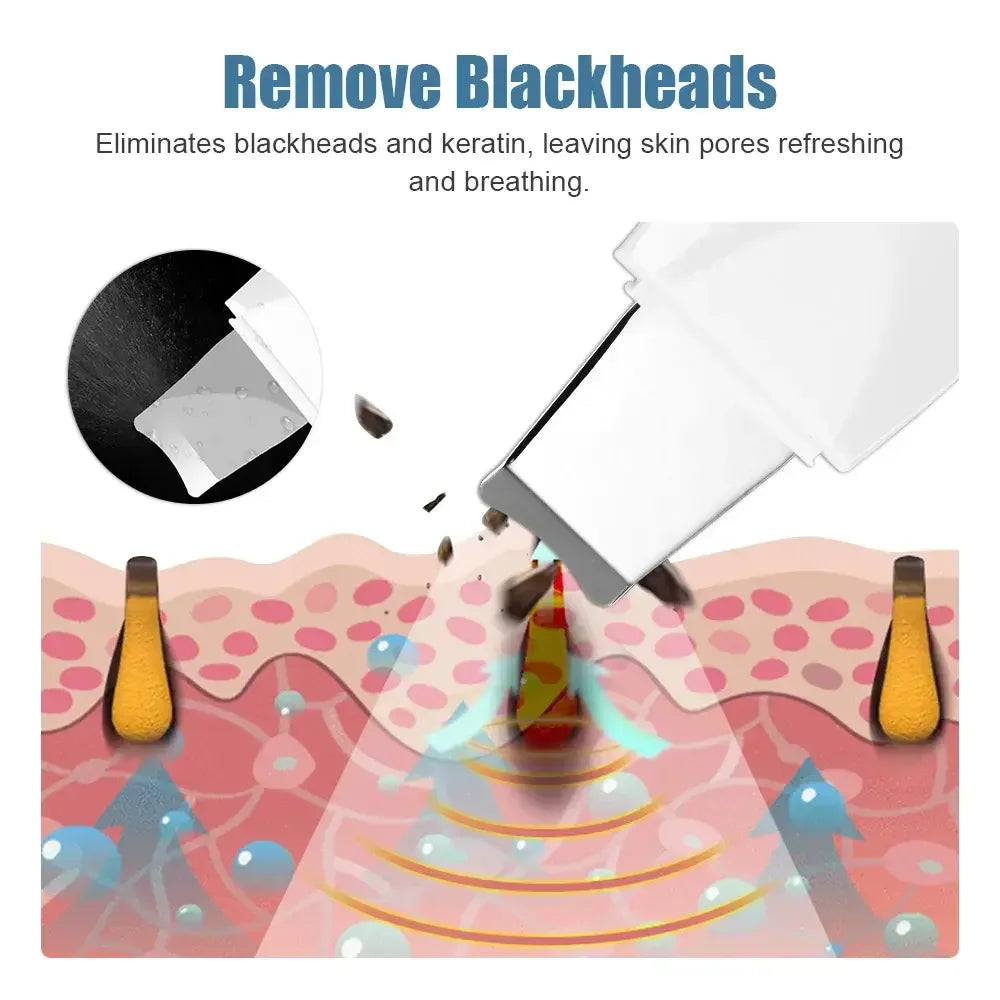 Deep Vibrating Skin Scrubber Facial Cleaner Spatula – Blackhead Remover & Pore Peeling Ultrasonic Facial Massager Tool