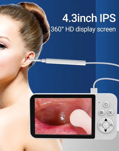 GUANMOU Digital Otoscope – 3.9mm Ear Scope Camera with 6 LED Lights, 4.3" IPS Ear Wax Removal Tool for Kids & Adults