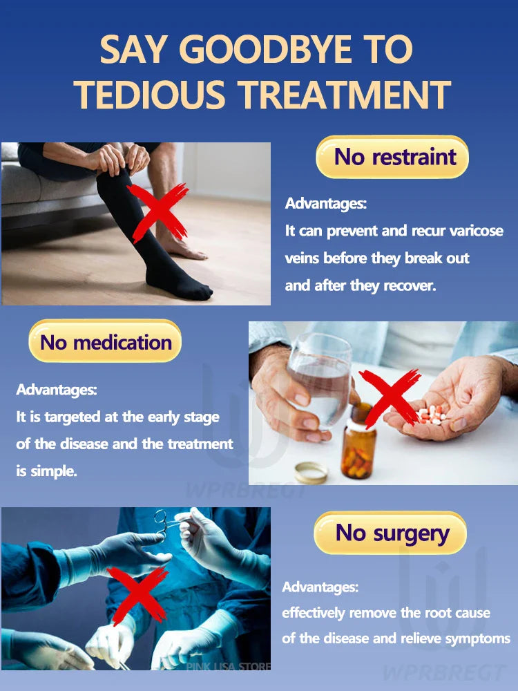 Varicose Vein & Spider Leg Pain Relief Treatment — Painless Care for Vasculitis & Phlebitis