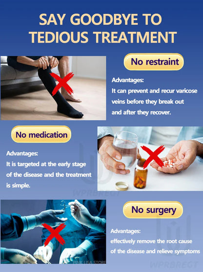Varicose Vein & Spider Leg Pain Relief Treatment — Painless Care for Vasculitis & Phlebitis