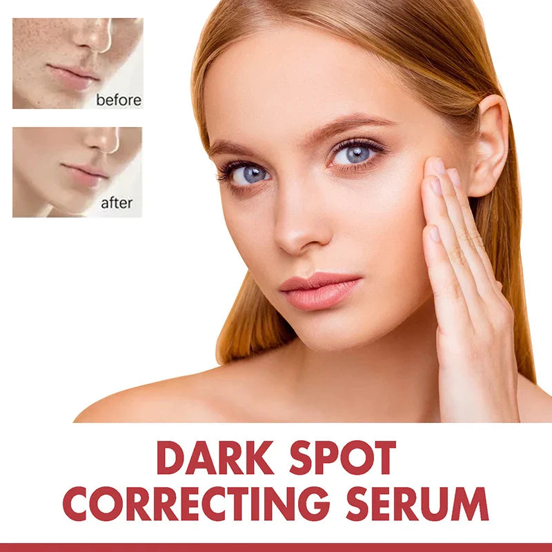 Niacinamide Serum – Dark Spot Correcting, Moisturizing & Brightening, Fades Fine Lines, Deep Cleansing Korean Skincare