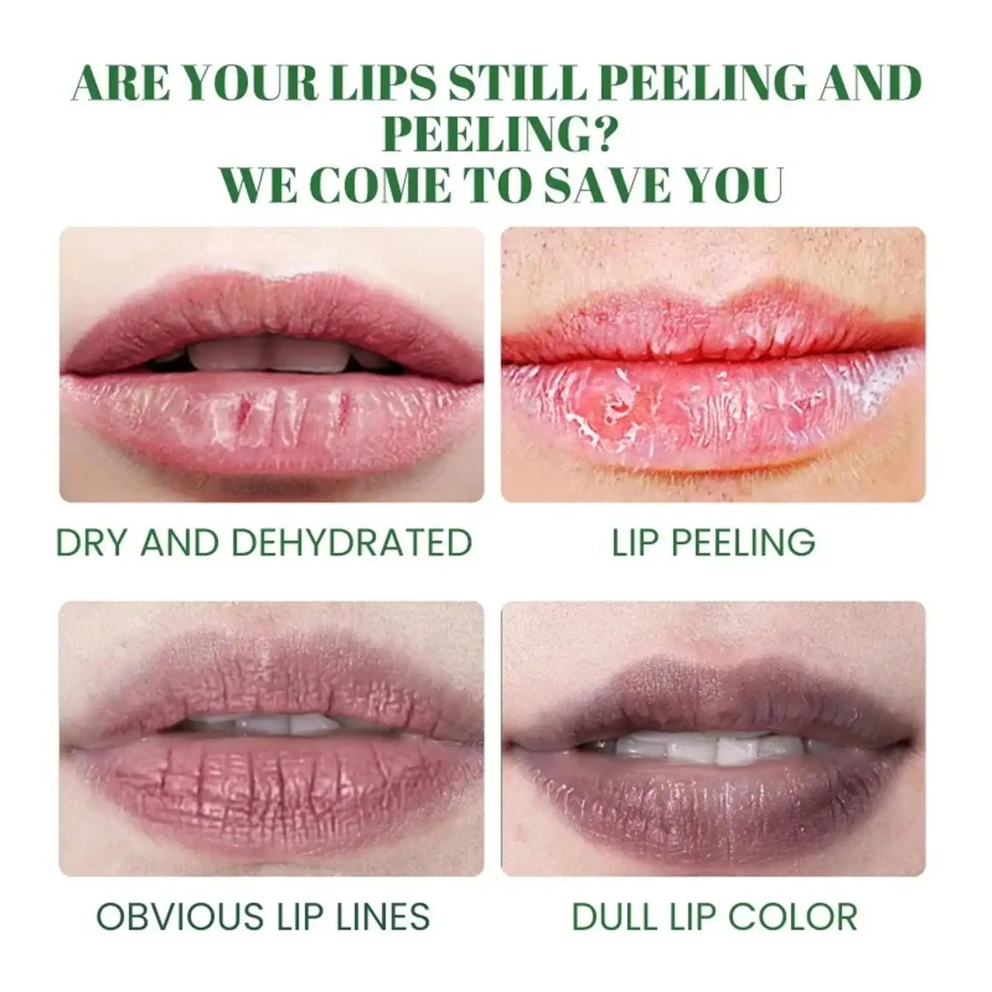 Lip Lightening Balm – Melanin Removing Gloss for Exfoliating and Moisturizing