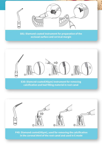 AZDENT 5pcs Dental Scaler Tips – Compatible with EMS, WOODPECKER, SATELEC, DTE, NSK Ultrasonic Scalers