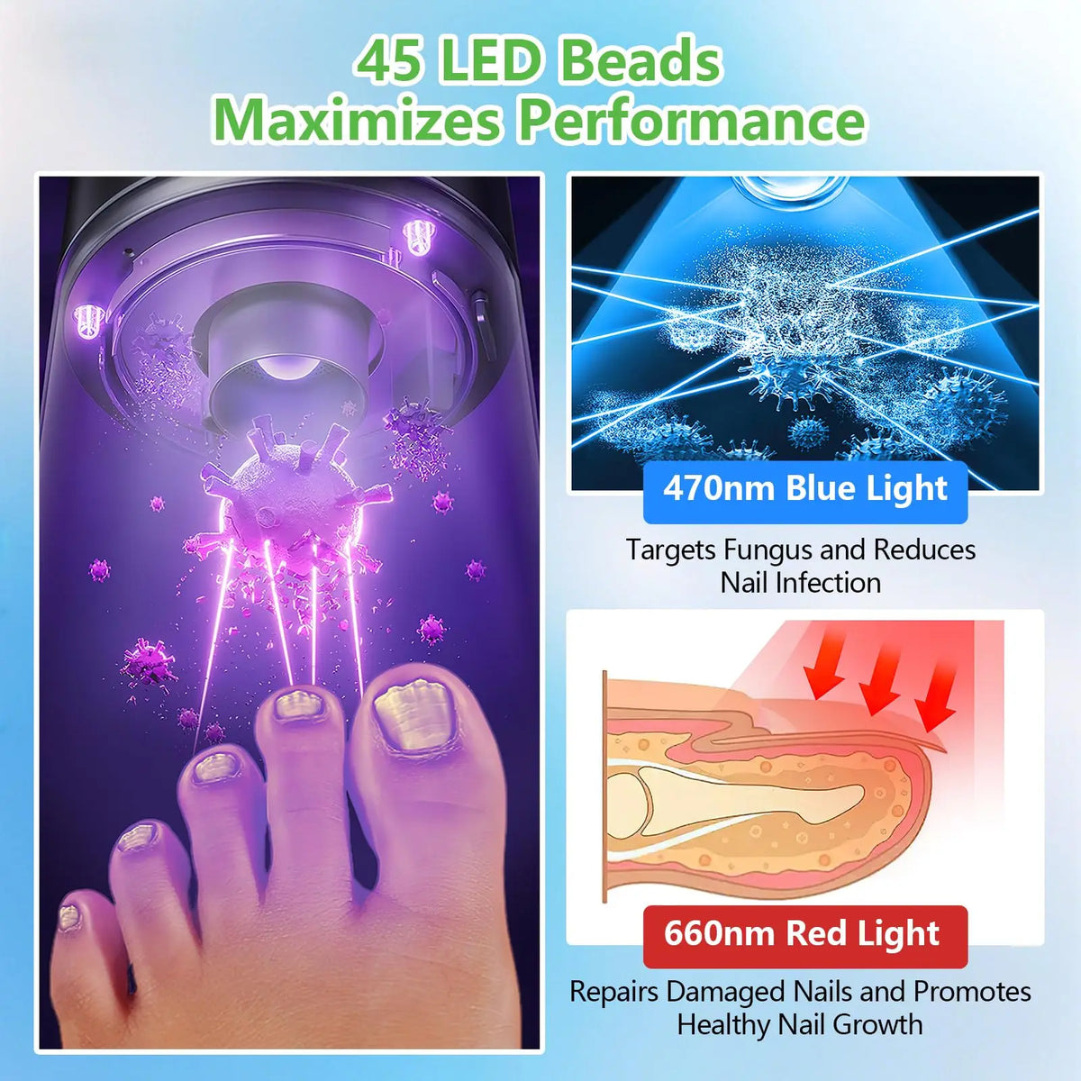 Laser Nail Fungus Treatment Device – Dual 15x470nm Blue & 30x650nm Red Light with Digital Display Nail Care System
