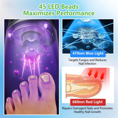 Laser Nail Fungus Treatment Device – 15x470nm Blue Light & 30x650nm Red Light with Digital Display for Nail Care