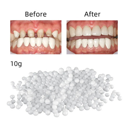 Temporary Tooth Repair Beads – Food Grade Dental Filling Material for Missing or Broken Teeth, False Teeth Glue, Denture Repair