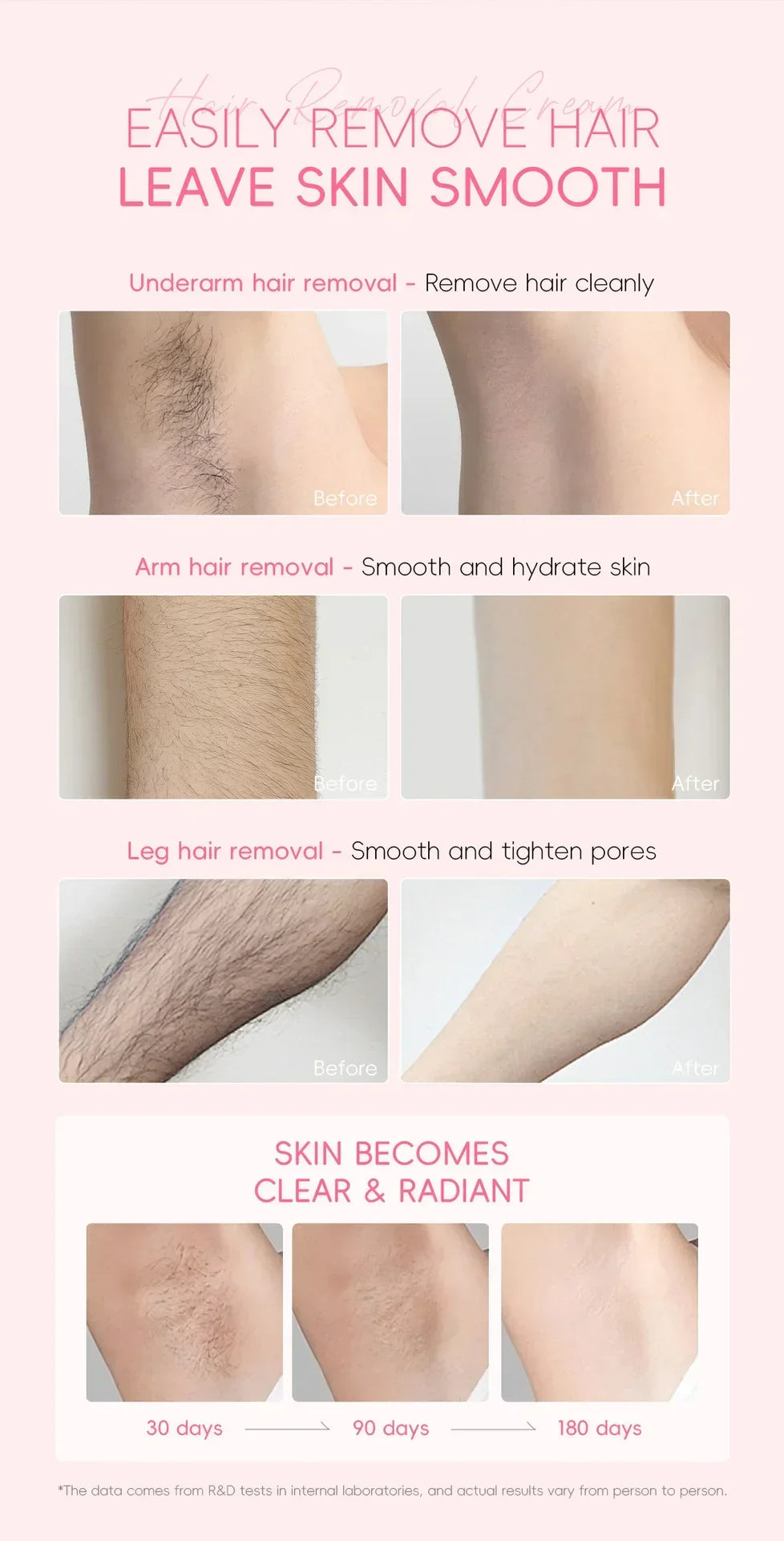 LAIKOU Hair Removal Cream 50g – Painless Epilator for Intimate Areas, Hair Growth Inhibitor, Body Care for Men & Women