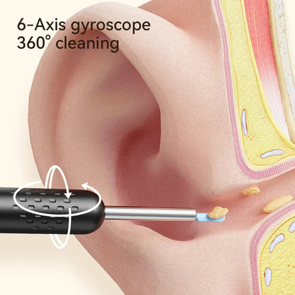 Ear Wax Removal Tool with 8M HD Camera – Ear Cleaner Endoscope with 6 LED Lights, Ear Cleaning Kit for Adults & Children