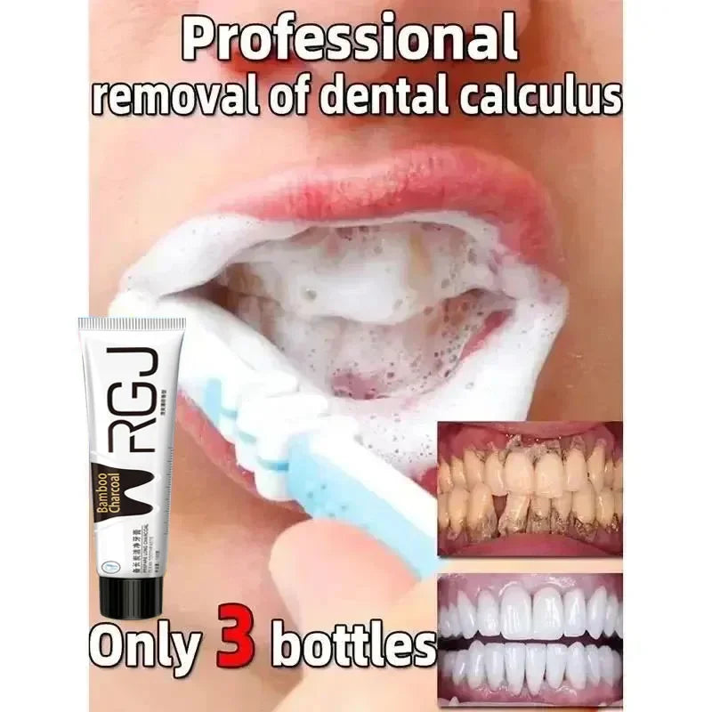 Dental Calculus Remover & Whitening Toothpaste – Fresh Breath & Periodontitis Prevention