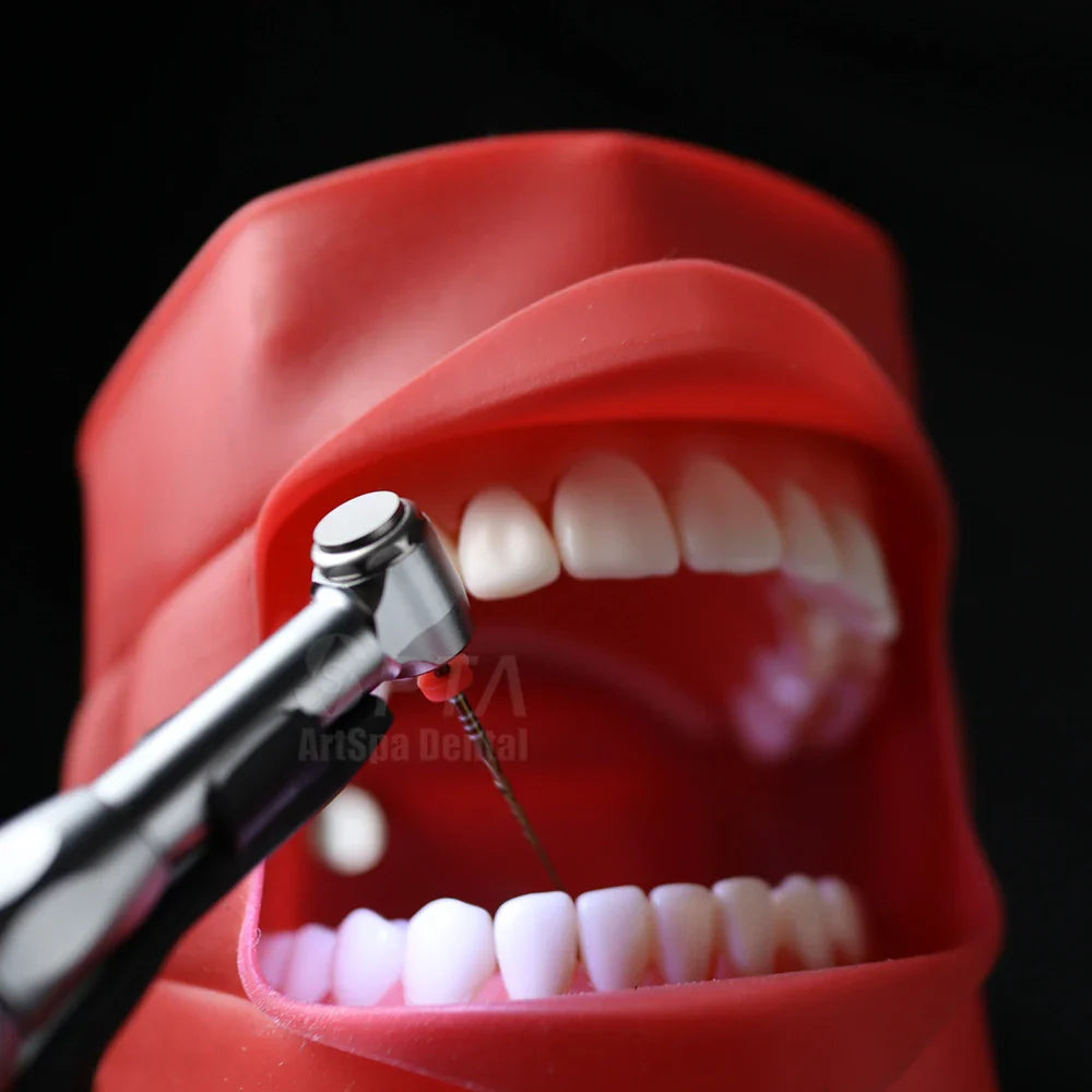 SPTA Cordless Dental Endo Motor – LED 16:1 Contra Angle with Reduction Head for Low-Speed Endodontic Treatment