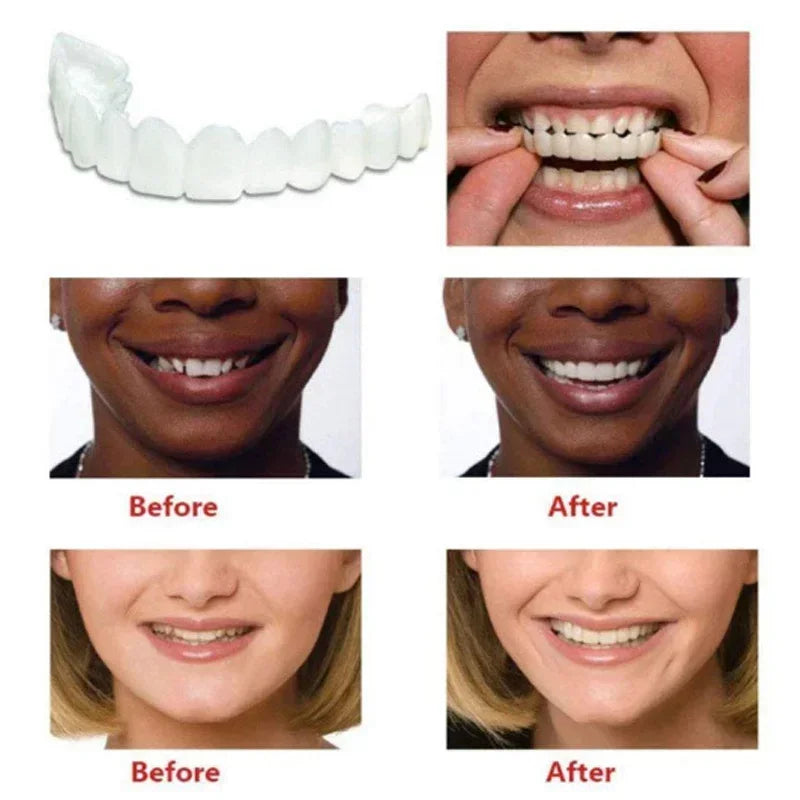Perfect Fit Snap-On Silicone Smile Veneers - Teeth Whitening Fake Tooth Cover, Upper False Tooth for Oral Hygiene Care
