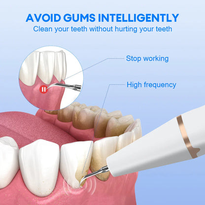 Ultrasonic Dental Plaque & Calculus Remover – Teeth Tartar Eliminator, Stains Cleaner, Electric Tooth Stone Scaler