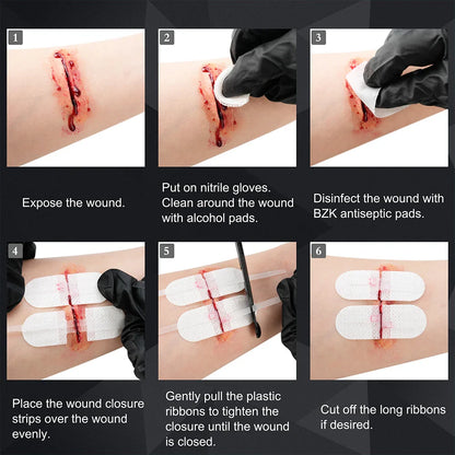 RHINO RESCUE Zip Stitch Wound Closure Kit – Dressings & Strips for Cut Care