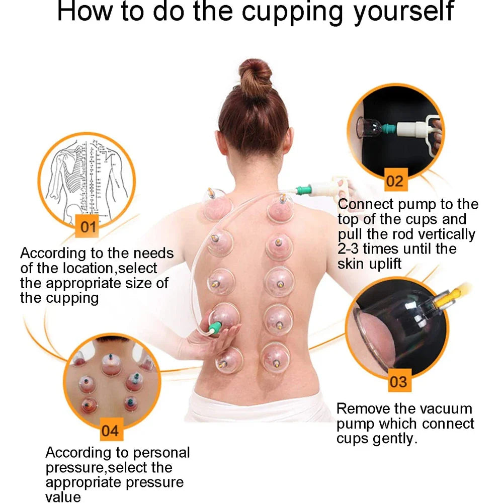 12/24-Cup Chinese Vacuum Cupping Therapy Set – Pull-Out Suction Massager for Pain Relief & Muscle Relaxation