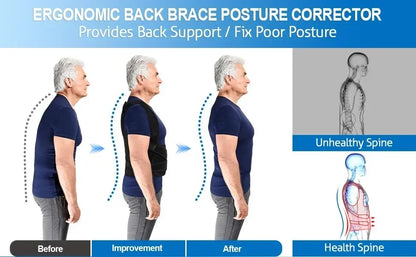 Adjustable Posture Corrector Back Brace – Orthopedic Spinal Support for Men & Women, Comfortable Upper Back Strap