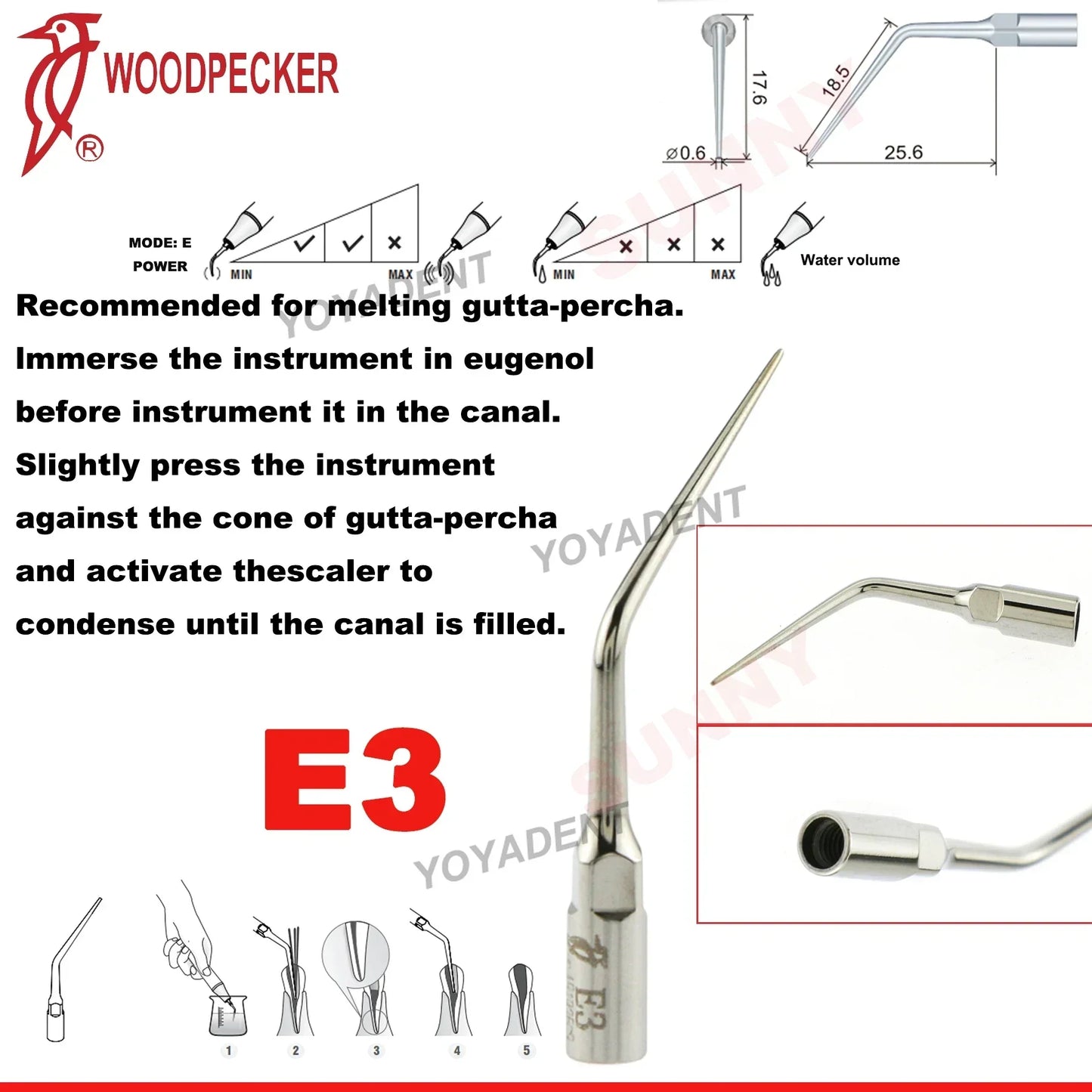 Woodpecker Dental Scaler Tips – Ultrasonic Tooth Cleaning, Endo & Perio Scaling Tips, Fit EMS UDS Scaler Handpiece