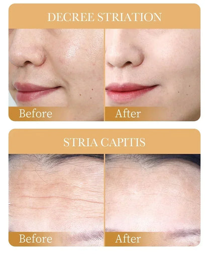 10pcs SADOER Collagen Face Masks – Anti-Wrinkle, Moisturizing & Brightening Skincare