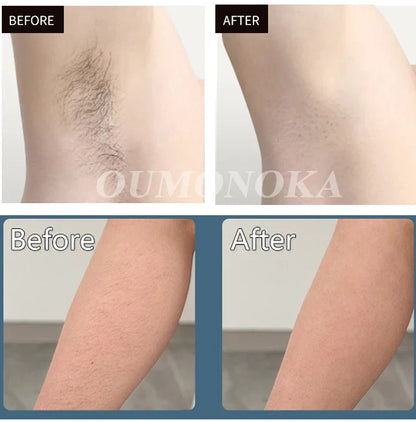 IPL Laser Hair Removal Device – 999,999 Flashes Painless Epilator for Women, Permanent At-Home Bikini & Body Hair Removal