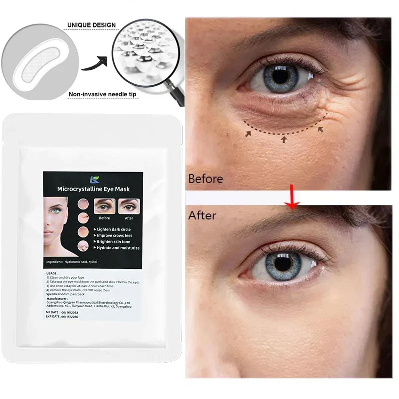 Micro-Needle Hyaluronic Acid Eye Patch – Anti-Wrinkle Moisturizing Eye Mask for Fine Lines Removal