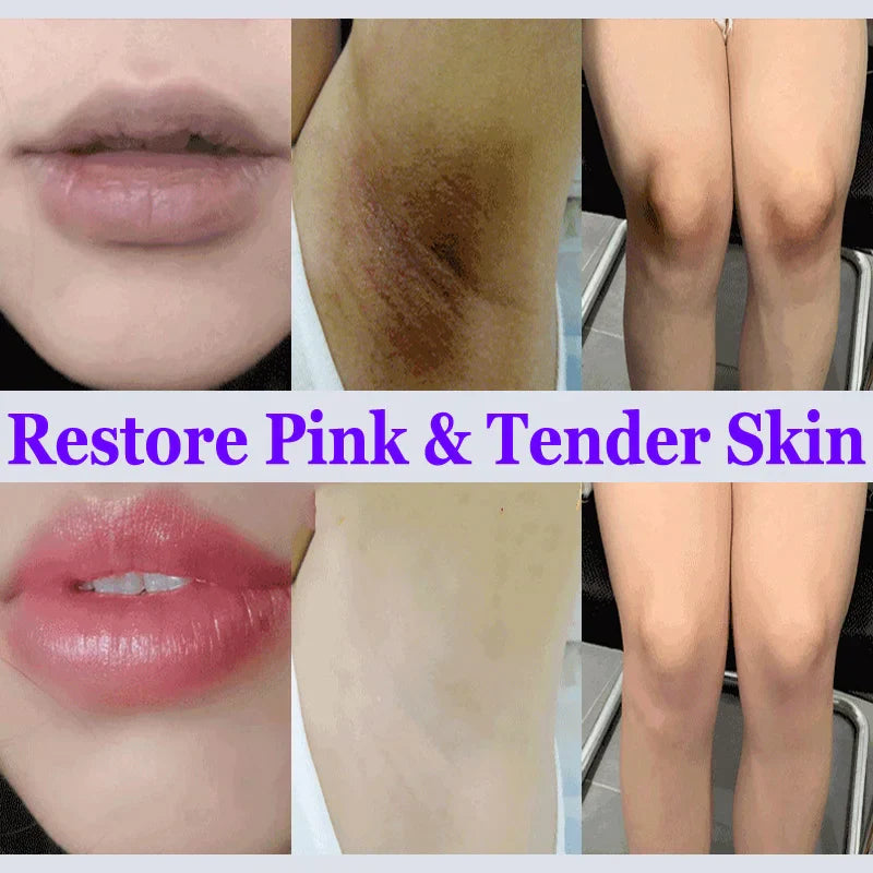 Whitening Cream for Private Parts – Underarm, Inner Thigh & Knee Brightening Serum