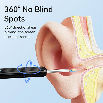 Visual Ear Wax Cleaner with Camera – Safe Earwax Removal Endoscope, 5M Luminous Otoscope & Ear Cleaning Tools for Ear Care