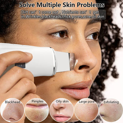Ultrasonic Peeling Remover: Blackhead Facial Skin Scrubber Shovel for Deep Cleaning, Face Lifting, Pore Acne Removal - EMS Lift