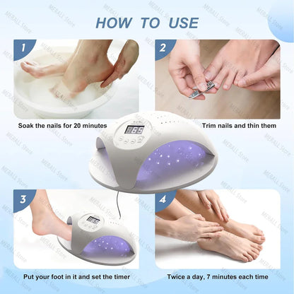 2-in-1 Fungal Nail Laser Device – Fast Repair for Toenail & Fingernail Fungus, Onychomycosis Treatment & Foot Care