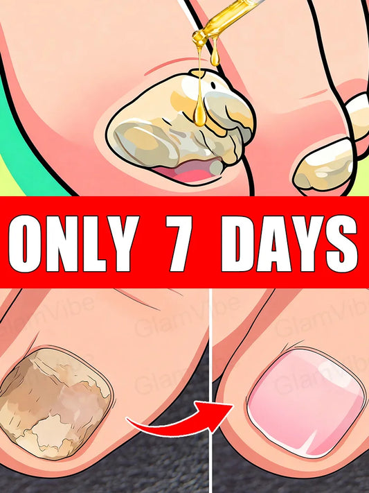 Quick Fungal Nail Treatment — Fast-Acting Solution to Say Goodbye to Nail Fungal Worries