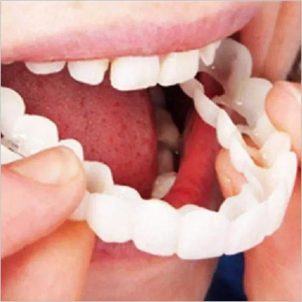 Perfect Fit Teeth Whitening Fake Tooth Cover – Snap-On Silicone Smile Veneers for Upper Teeth, Reusable Cosmetic Tool