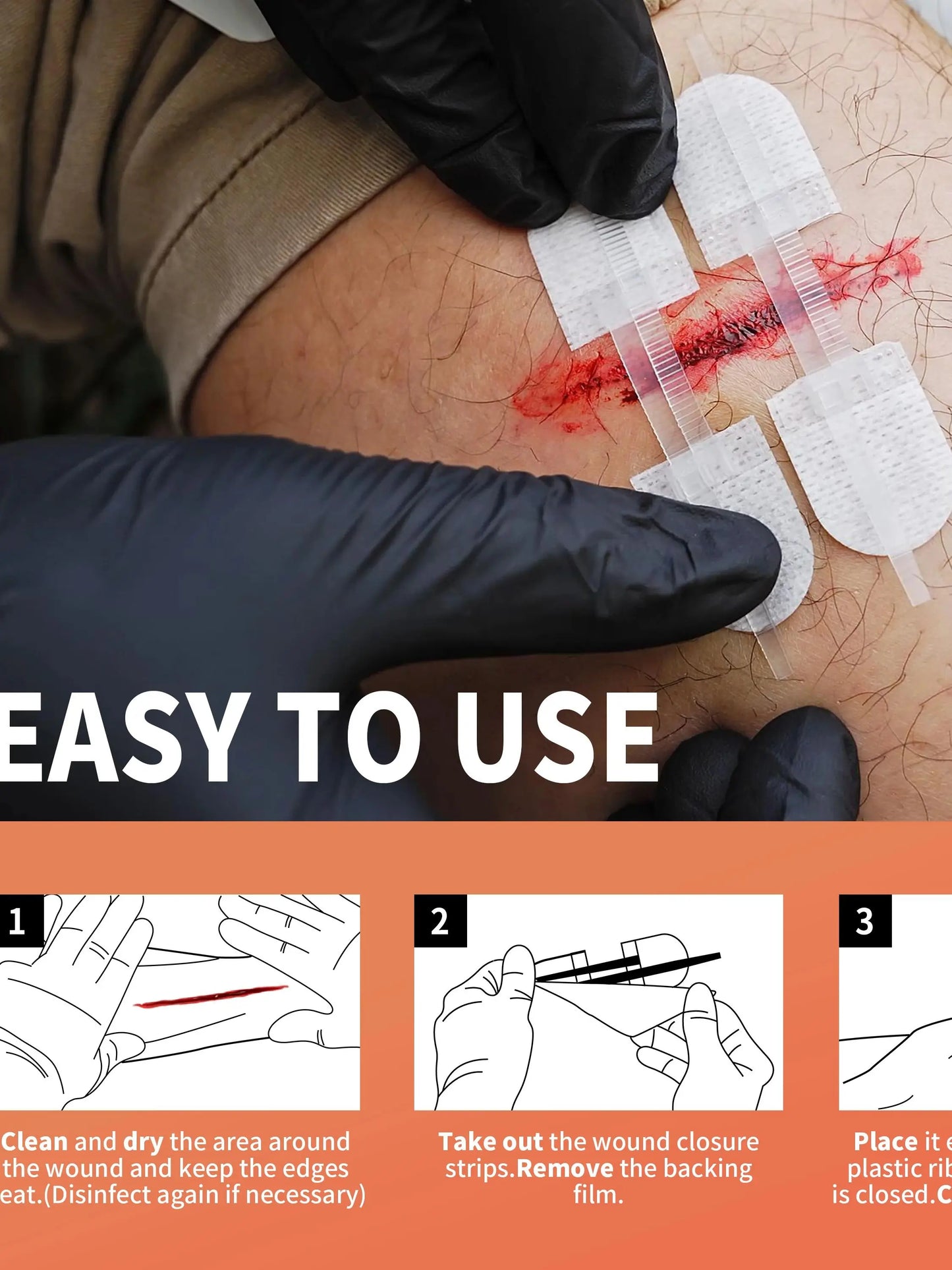 RHINO RESCUE Zip Stitch — Wound Closure Strips, Adhesive Bandages for Cut Care Without Sutures