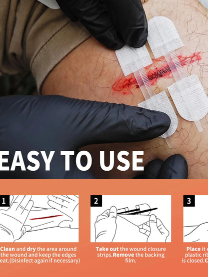 RHINO RESCUE Zip Stitch — Wound Closure Strips, Adhesive Bandages for Cut Care Without Sutures