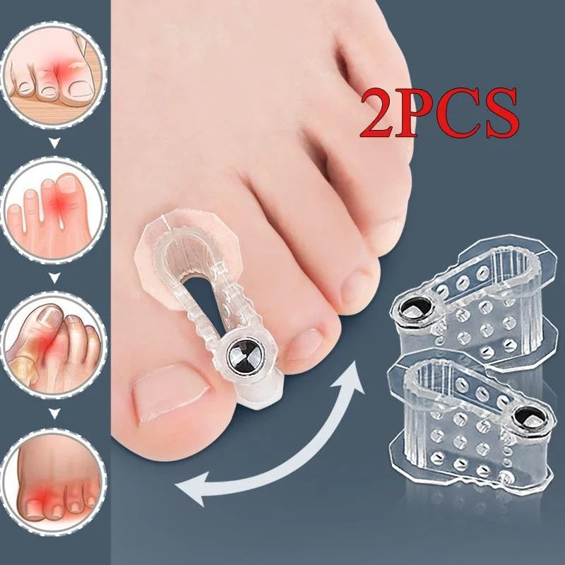 Bunion Toe Correctors - 2-Piece Hallux Valgus Spacers for Toe Alignment & Foot Care